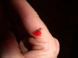 Blut an meiner Hand